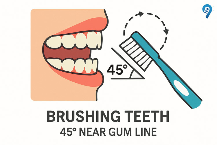 Step-by-Step-Brushing-Technique-Angle-Motion-Coverage